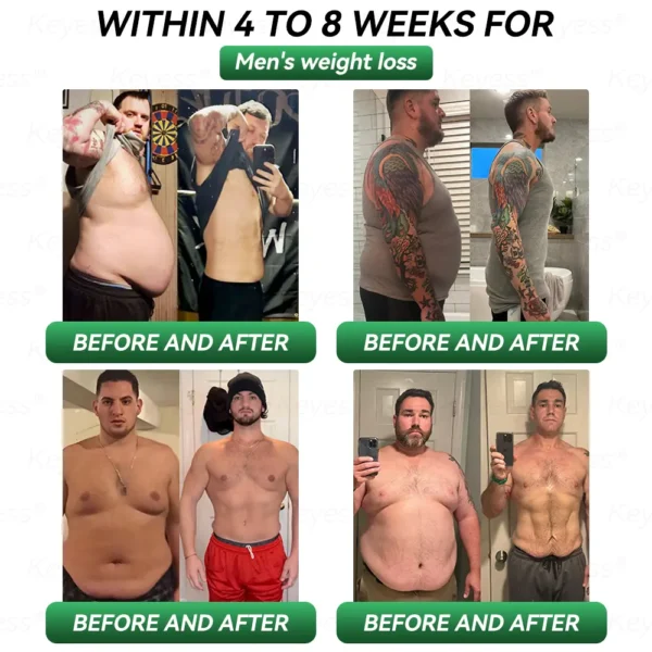 𝐎𝐟𝐟𝐢𝐜𝐢𝐚𝐥 𝐒𝐭𝐨𝐫𝐞 | 𝐊𝐞𝐲𝐞𝐬𝐬® 𝐆𝐋𝐏-𝟏 & 𝐌𝐚𝐭𝐫𝐢𝐱𝐲𝐥 𝟑𝟎𝟎𝟎 𝐒𝐥𝐢𝐦𝐦𝐢𝐧𝐠 & 𝐇𝐞𝐚𝐥𝐭𝐡 𝐃𝐫𝐨𝐩𝐬👩‍⚕️(𝐉𝐮𝐬𝐭 𝐨𝐧𝐞 𝐝𝐨𝐬𝐞 𝐚 𝐝𝐚𝐲 — 𝐯𝐢𝐬𝐢𝐛𝐥𝐞 𝐫𝐞𝐬𝐮𝐥𝐭𝐬 𝐢𝐧 𝐣𝐮𝐬𝐭 𝟕 𝐝𝐚𝐲𝐬)🎁𝐅𝐨𝐫 𝐨𝐛𝐞𝐬𝐢𝐭𝐲, 𝐜𝐚𝐫𝐝𝐢𝐨𝐯𝐚𝐬𝐜𝐮𝐥𝐚𝐫 𝐡𝐞𝐚𝐥𝐭𝐡, 𝐝𝐢𝐚𝐛𝐞𝐭𝐞𝐬, 𝐬𝐥𝐞𝐞𝐩 𝐚𝐩𝐧𝐞𝐚, 𝐣𝐨𝐢𝐧𝐭 𝐢𝐬𝐬𝐮𝐞𝐬, 𝐚𝐧𝐝 𝐦𝐨𝐫𝐞
