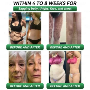 𝐎𝐟𝐟𝐢𝐜𝐢𝐚𝐥 𝐒𝐭𝐨𝐫𝐞 | 𝐊𝐞𝐲𝐞𝐬𝐬® 𝐆𝐋𝐏-𝟏 & 𝐌𝐚𝐭𝐫𝐢𝐱𝐲𝐥 𝟑𝟎𝟎𝟎 𝐒𝐥𝐢𝐦𝐦𝐢𝐧𝐠 & 𝐇𝐞𝐚𝐥𝐭𝐡 𝐃𝐫𝐨𝐩𝐬👩‍⚕️(𝐉𝐮𝐬𝐭 𝐨𝐧𝐞 𝐝𝐨𝐬𝐞 𝐚 𝐝𝐚𝐲 — 𝐯𝐢𝐬𝐢𝐛𝐥𝐞 𝐫𝐞𝐬𝐮𝐥𝐭𝐬 𝐢𝐧 𝐣𝐮𝐬𝐭 𝟕 𝐝𝐚𝐲𝐬)🎁𝐅𝐨𝐫 𝐨𝐛𝐞𝐬𝐢𝐭𝐲, 𝐜𝐚𝐫𝐝𝐢𝐨𝐯𝐚𝐬𝐜𝐮𝐥𝐚𝐫 𝐡𝐞𝐚𝐥𝐭𝐡, 𝐝𝐢𝐚𝐛𝐞𝐭𝐞𝐬, 𝐬𝐥𝐞𝐞𝐩 𝐚𝐩𝐧𝐞𝐚, 𝐣𝐨𝐢𝐧𝐭 𝐢𝐬𝐬𝐮𝐞𝐬, 𝐚𝐧𝐝 𝐦𝐨𝐫𝐞