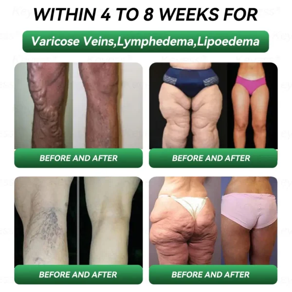 𝐎𝐟𝐟𝐢𝐜𝐢𝐚𝐥 𝐒𝐭𝐨𝐫𝐞 | 𝐊𝐞𝐲𝐞𝐬𝐬® 𝐆𝐋𝐏-𝟏 & 𝐌𝐚𝐭𝐫𝐢𝐱𝐲𝐥 𝟑𝟎𝟎𝟎 𝐒𝐥𝐢𝐦𝐦𝐢𝐧𝐠 & 𝐇𝐞𝐚𝐥𝐭𝐡 𝐃𝐫𝐨𝐩𝐬👩‍⚕️(𝐉𝐮𝐬𝐭 𝐨𝐧𝐞 𝐝𝐨𝐬𝐞 𝐚 𝐝𝐚𝐲 — 𝐯𝐢𝐬𝐢𝐛𝐥𝐞 𝐫𝐞𝐬𝐮𝐥𝐭𝐬 𝐢𝐧 𝐣𝐮𝐬𝐭 𝟕 𝐝𝐚𝐲𝐬)🎁𝐅𝐨𝐫 𝐨𝐛𝐞𝐬𝐢𝐭𝐲, 𝐜𝐚𝐫𝐝𝐢𝐨𝐯𝐚𝐬𝐜𝐮𝐥𝐚𝐫 𝐡𝐞𝐚𝐥𝐭𝐡, 𝐝𝐢𝐚𝐛𝐞𝐭𝐞𝐬, 𝐬𝐥𝐞𝐞𝐩 𝐚𝐩𝐧𝐞𝐚, 𝐣𝐨𝐢𝐧𝐭 𝐢𝐬𝐬𝐮𝐞𝐬, 𝐚𝐧𝐝 𝐦𝐨𝐫𝐞