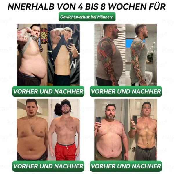 𝐎𝐟𝐟𝐢𝐳𝐢𝐞𝐥𝐥𝐞𝐫 𝐒𝐡𝐨𝐩| 𝐊𝐞𝐲𝐞𝐬𝐬® GLP-1 & Matrixyl 3000 Schlankheits- & Gesundheits-Tropfen💧 (nur eine Dosis pro Tag – sichtbare Ergebnisse in nur 7 Tagen) ✅ Geeignet für Fettleibigkeit, Herz-Kreislauf-Gesundheit, Diabetes, Schlafapnoe, Gelenkprobleme und mehr🥇
