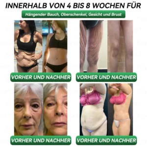 𝐎𝐟𝐟𝐢𝐳𝐢𝐞𝐥𝐥𝐞𝐫 𝐒𝐡𝐨𝐩| 𝐊𝐞𝐲𝐞𝐬𝐬® GLP-1 & Matrixyl 3000 Schlankheits- & Gesundheits-Tropfen💧 (nur eine Dosis pro Tag – sichtbare Ergebnisse in nur 7 Tagen) ✅ Geeignet für Fettleibigkeit, Herz-Kreislauf-Gesundheit, Diabetes, Schlafapnoe, Gelenkprobleme und mehr🥇