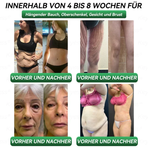 𝐎𝐟𝐟𝐢𝐳𝐢𝐞𝐥𝐥𝐞𝐫 𝐒𝐡𝐨𝐩| 𝐊𝐞𝐲𝐞𝐬𝐬® GLP-1 & Matrixyl 3000 Schlankheits- & Gesundheits-Tropfen💧 (nur eine Dosis pro Tag – sichtbare Ergebnisse in nur 7 Tagen) ✅ Geeignet für Fettleibigkeit, Herz-Kreislauf-Gesundheit, Diabetes, Schlafapnoe, Gelenkprobleme und mehr🥇