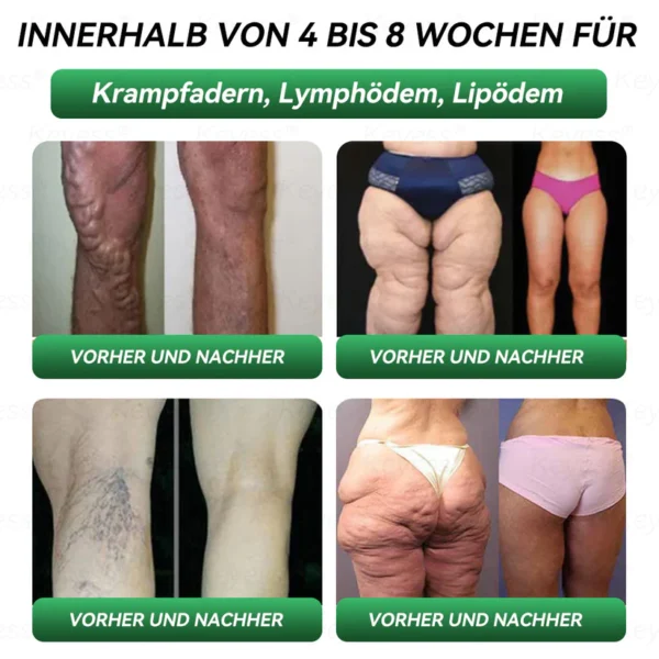 𝐎𝐟𝐟𝐢𝐳𝐢𝐞𝐥𝐥𝐞𝐫 𝐒𝐡𝐨𝐩| 𝐊𝐞𝐲𝐞𝐬𝐬® GLP-1 & Matrixyl 3000 Schlankheits- & Gesundheits-Tropfen💧 (nur eine Dosis pro Tag – sichtbare Ergebnisse in nur 7 Tagen) ✅ Geeignet für Fettleibigkeit, Herz-Kreislauf-Gesundheit, Diabetes, Schlafapnoe, Gelenkprobleme und mehr🥇