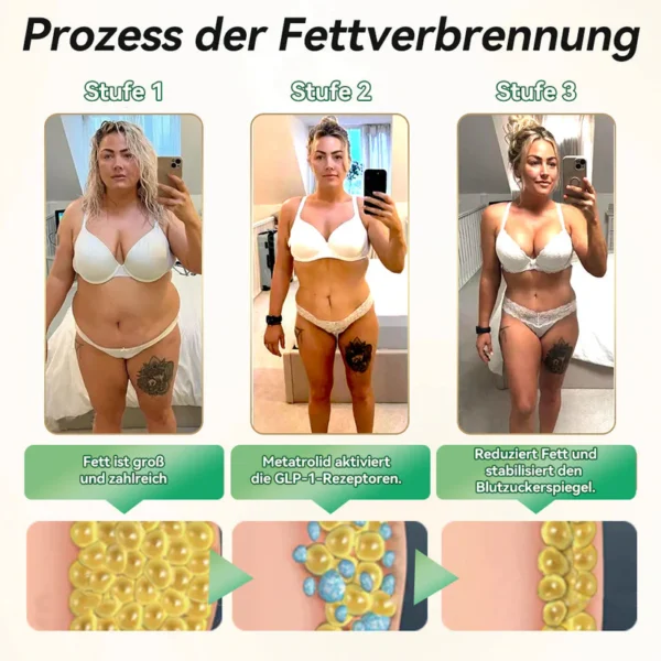 𝐎𝐟𝐟𝐢𝐳𝐢𝐞𝐥𝐥𝐞𝐫 𝐒𝐡𝐨𝐩| 𝐊𝐞𝐲𝐞𝐬𝐬® GLP-1 & Matrixyl 3000 Schlankheits- & Gesundheits-Tropfen💧 (nur eine Dosis pro Tag – sichtbare Ergebnisse in nur 7 Tagen) ✅ Geeignet für Fettleibigkeit, Herz-Kreislauf-Gesundheit, Diabetes, Schlafapnoe, Gelenkprobleme und mehr🥇