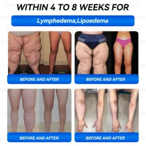 ใRoyal Warrant Holderใ๐๐๐๐ข๐๐ข๐๐๐๐ฒ ๐๐ฎ๐ญ๐ก๐จ๐ซ๐ข๐ฌ๐๐ ๐๐ฑ๐๐ฅ๐ฎ๐ฌ๐ข๐ฏ๐ ๐๐๐ข๐ญ๐ข๐จ๐ง | ๐๐๐ฎ๐๐๐ยฎ ๐ ๐ ๐-๐ ๐๐ซ๐ผ๐๐๐ผ๐ญ๐๐ ๐
๐ฎ๐น๐น-๐๐ผ๐๐ฒ ๐๐๐ฎ๐น๐ฉ๐ญ๐ข๐ง๐ & ๐๐๐๐ฅ๐ญ๐ก ๐๐ผ๐ผ๐ฌ๐ญ ๐๐๐ญ๐ญ๐น๐ ๐๐น๐ฎ๐ ๐๐๐ซ๐