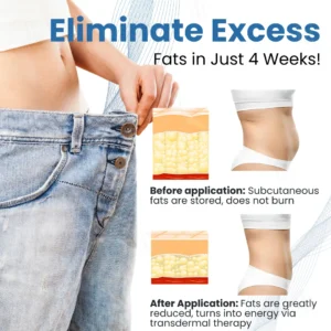 AEXZR® Clinical Body Sculpting System