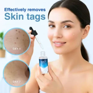 RZXEA™ Advanced Skin Tag & Wart Removal Essence