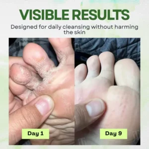 RZXEA™ Spore Defense Relief Soap Bar