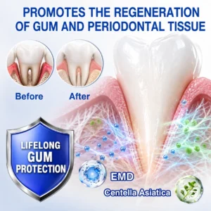 𝑲𝒆𝒚𝒆𝒔𝒔® GumRevive