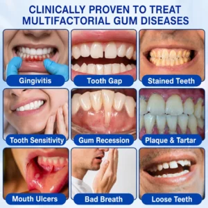 𝑲𝒆𝒚𝒆𝒔𝒔® GumRevive
