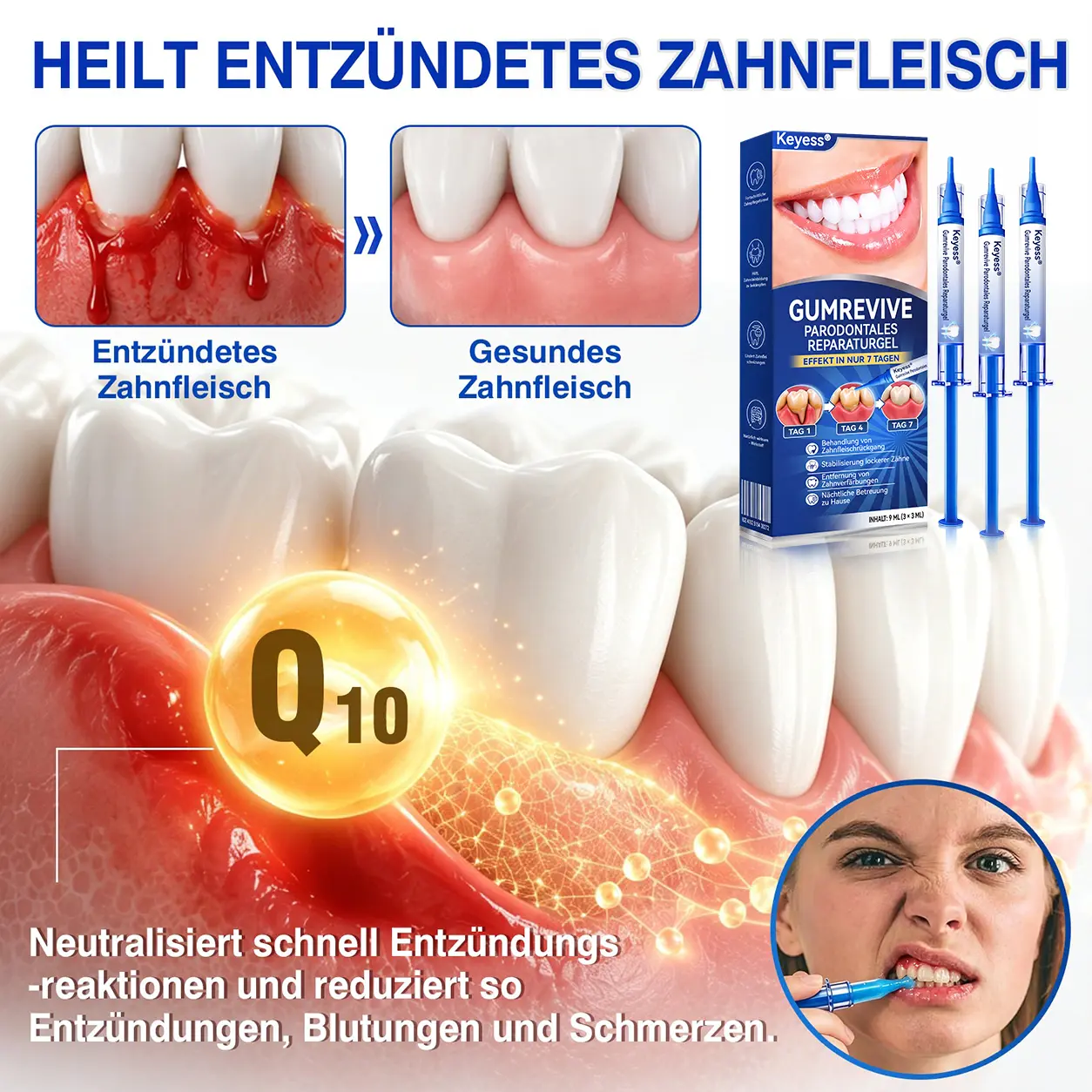 Keyess® GumRevive Zahnfleisch- Regenerationsgel 