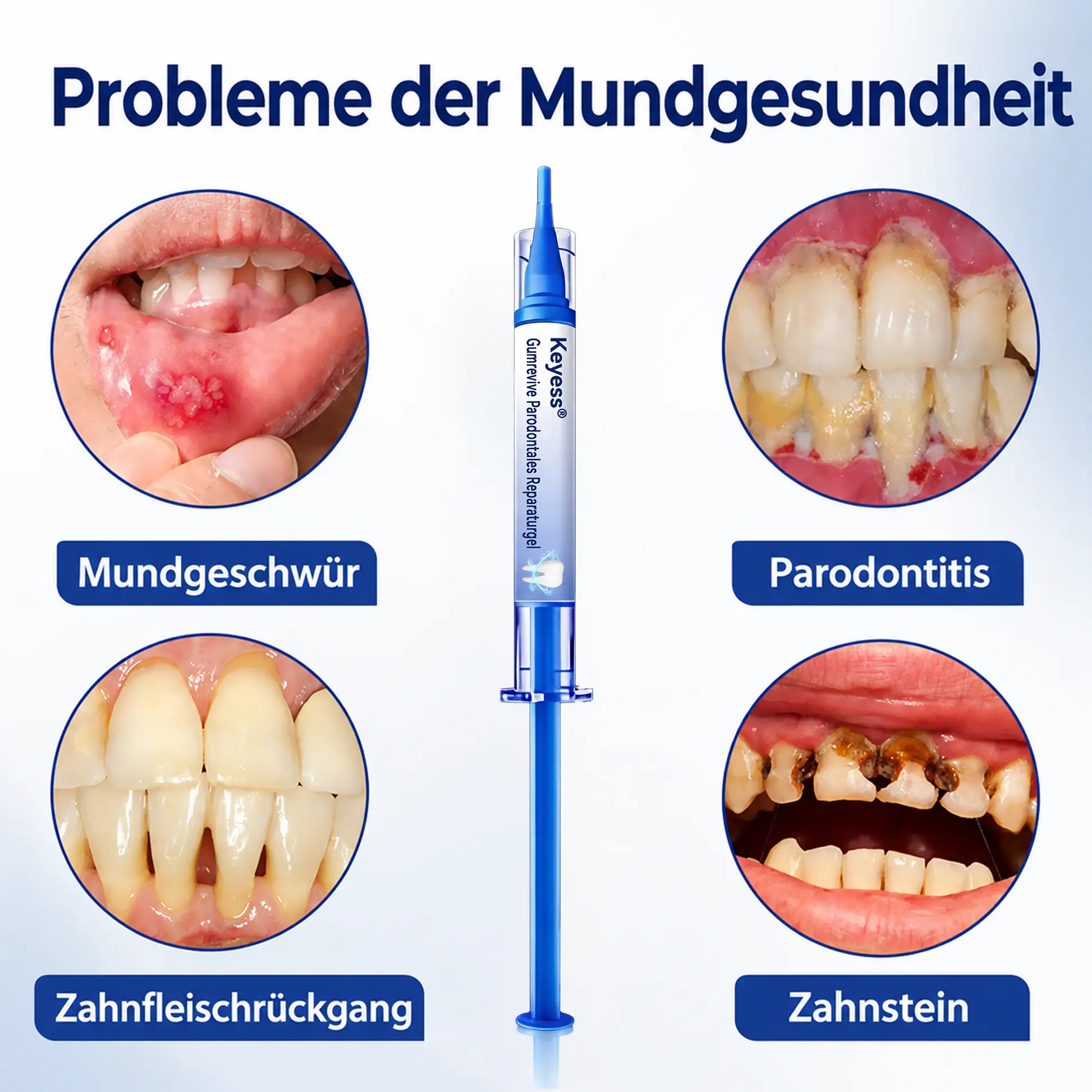 Keyess® GumRevive Zahnfleisch- Regenerationsgel 