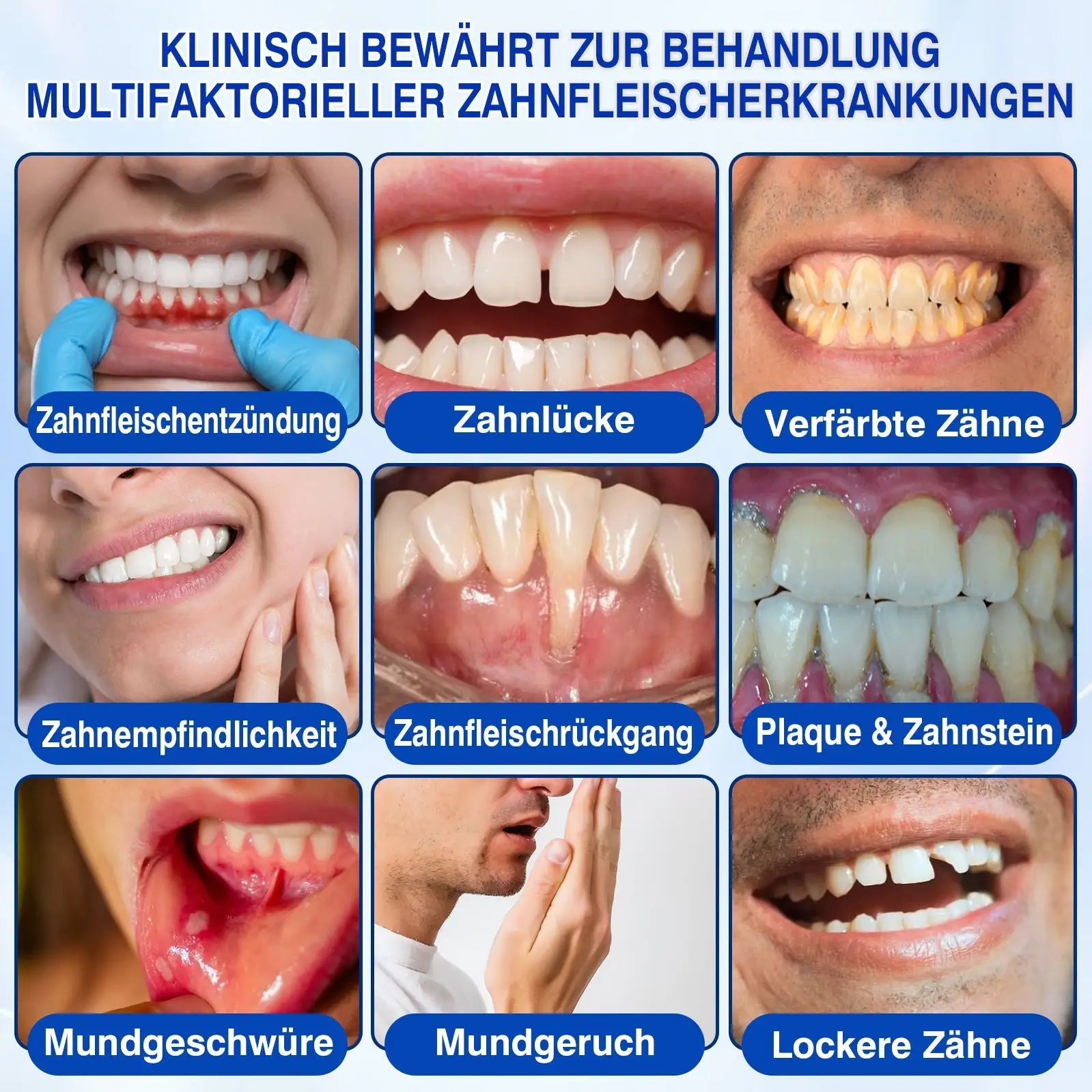 Keyess® GumRevive Zahnfleisch- Regenerationsgel 