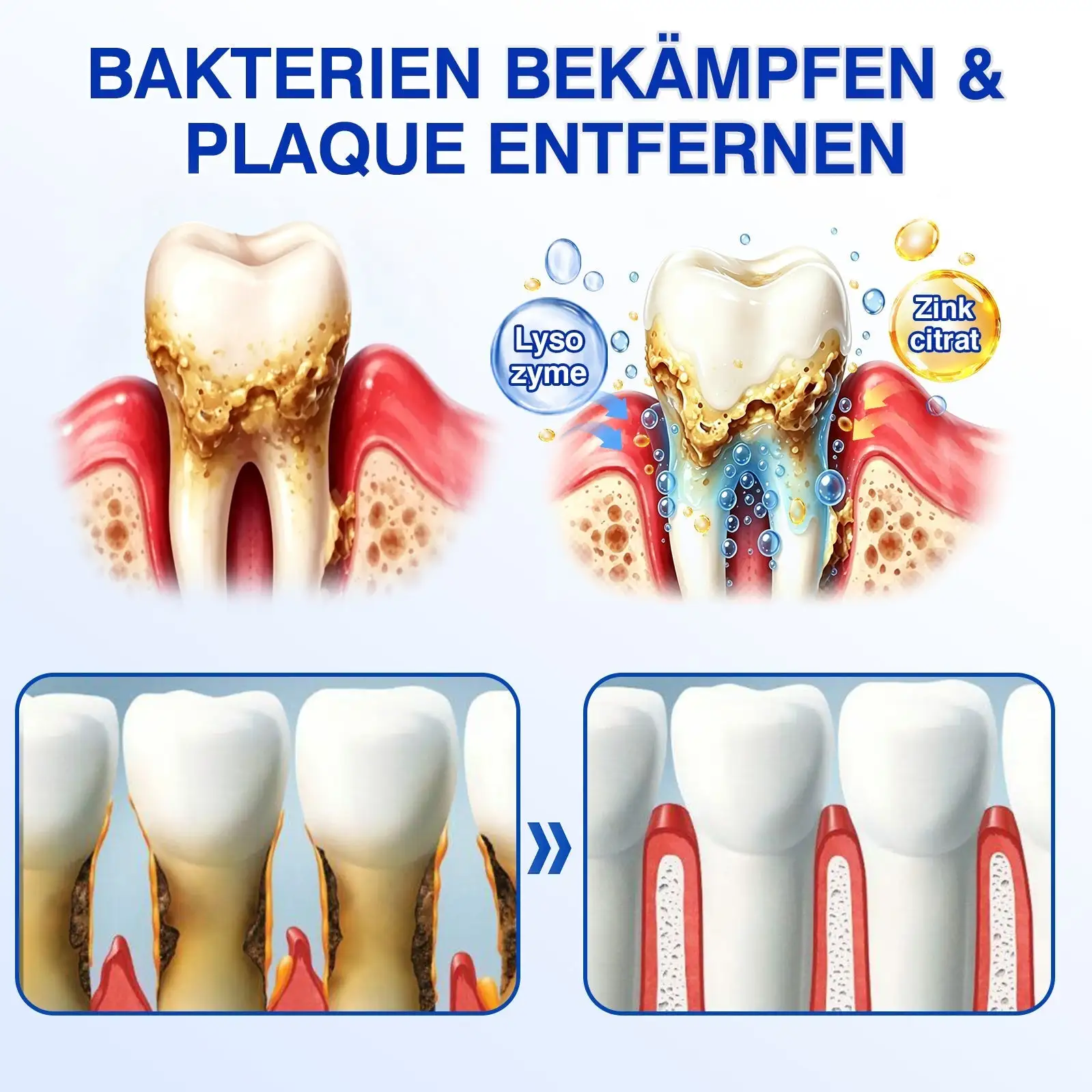 Keyess® GumRevive Zahnfleisch- Regenerationsgel 