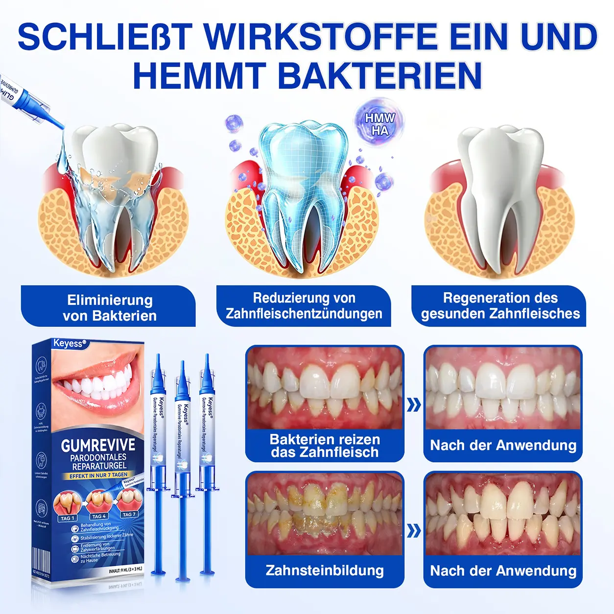 Keyess® GumRevive Zahnfleisch- Regenerationsgel 